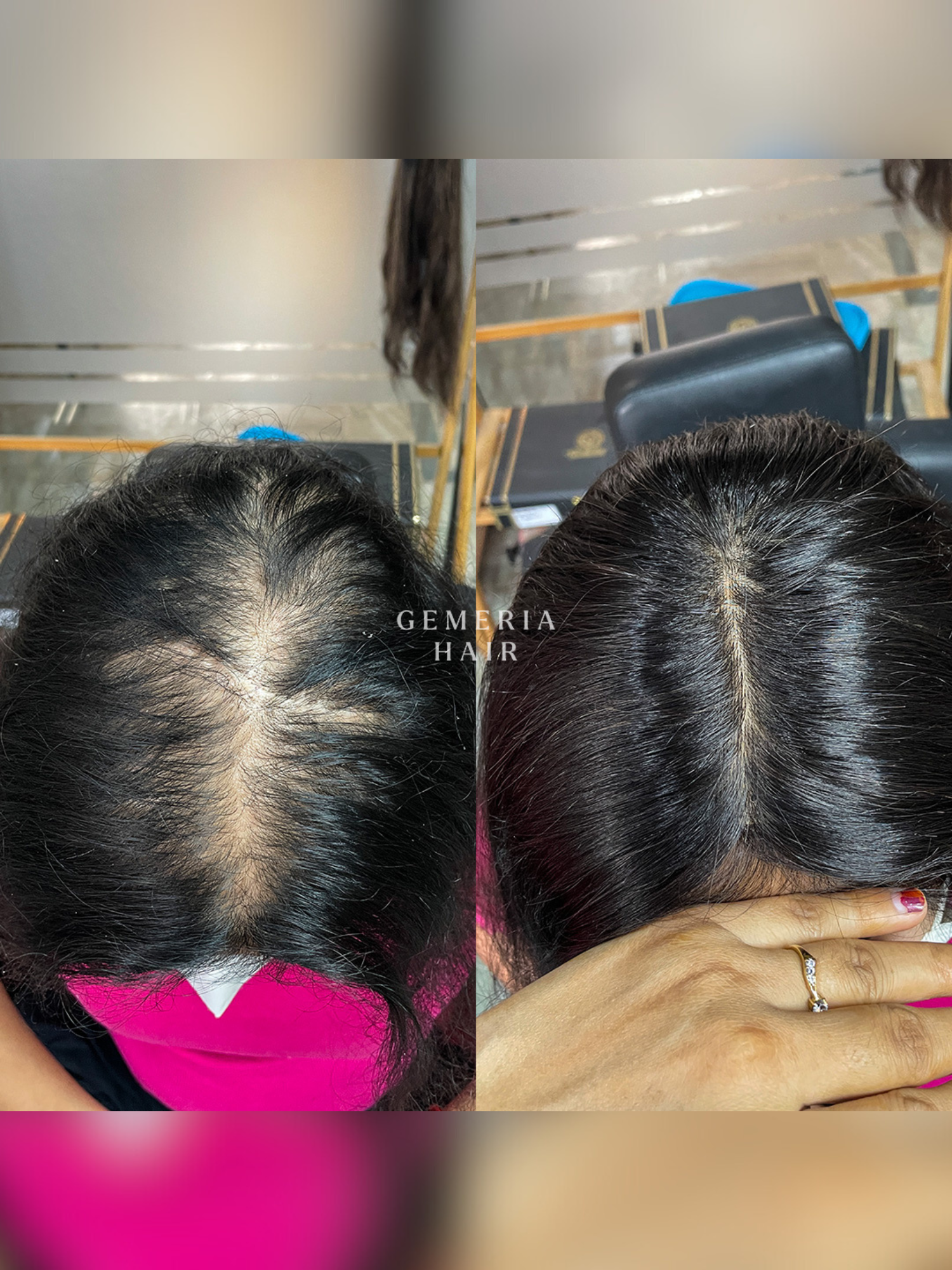 1.5x5 | Full Silk Hair Topper