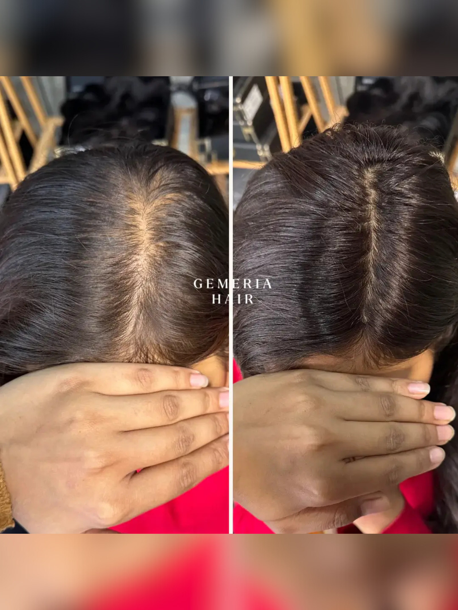 1.5x5 | Full Silk Hair Topper