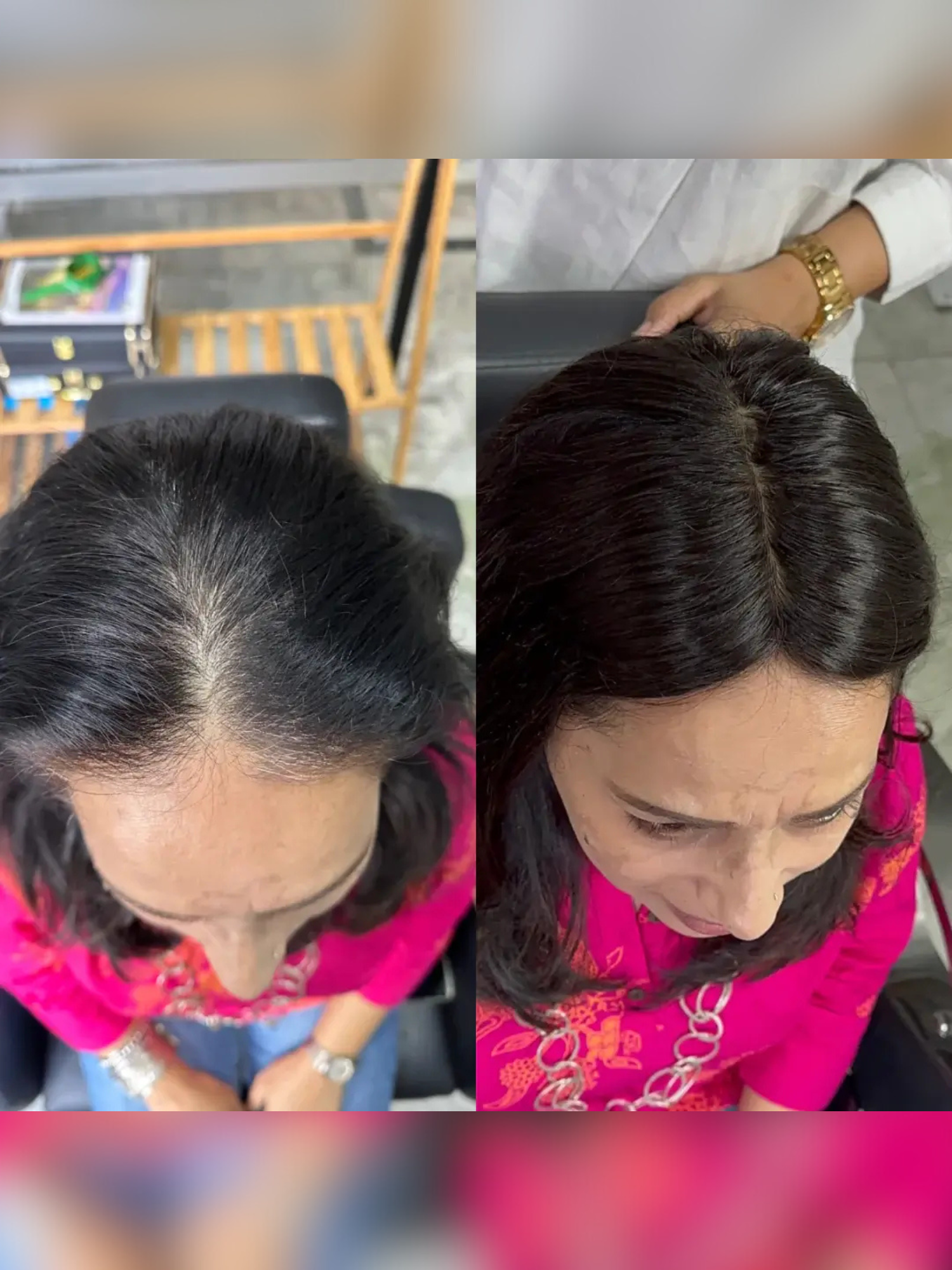 1.5x5 | Full Silk Hair Topper