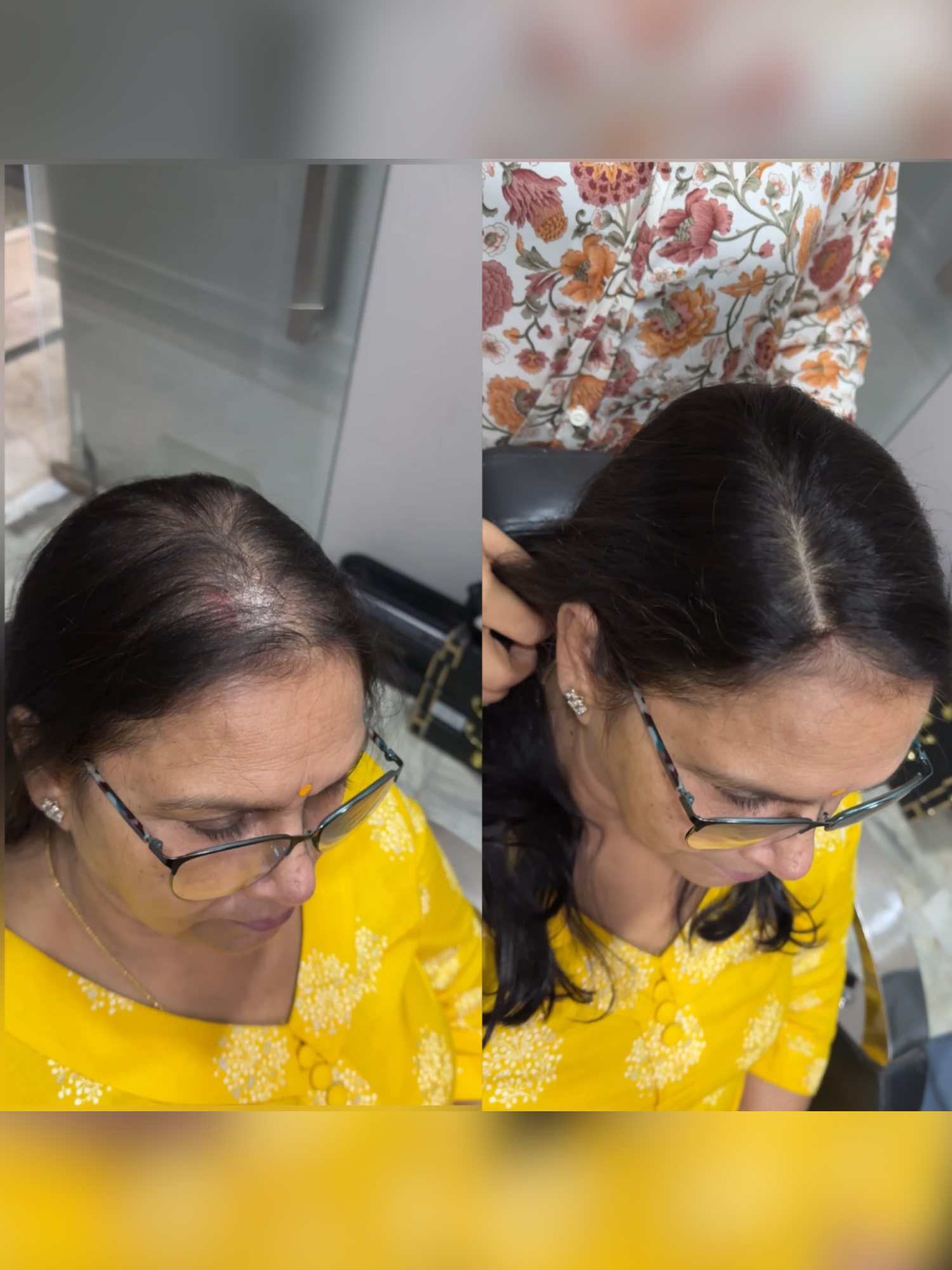 1.5x5 | Full Silk Hair Topper