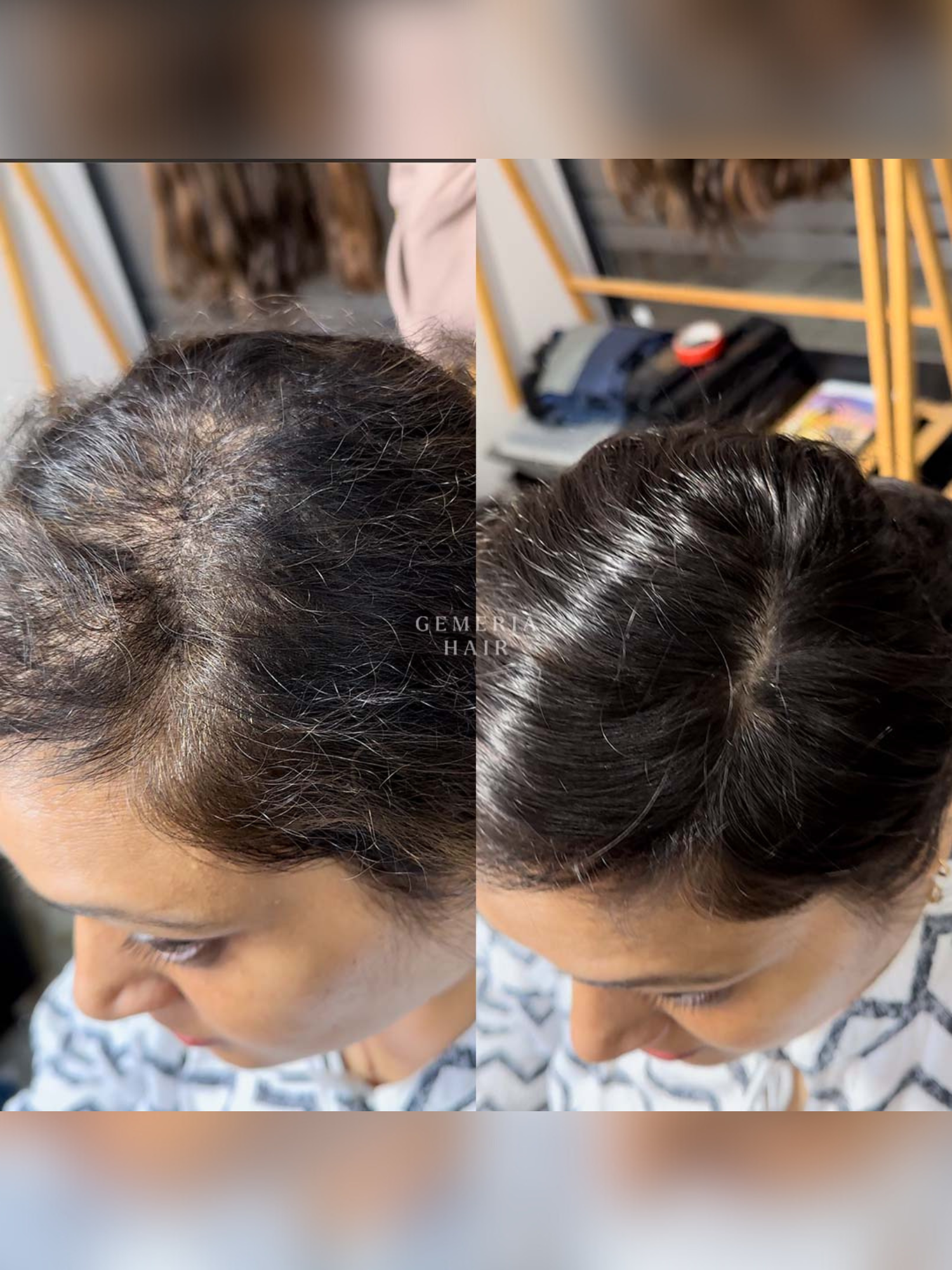 2x4 | Full Silk Hair Topper