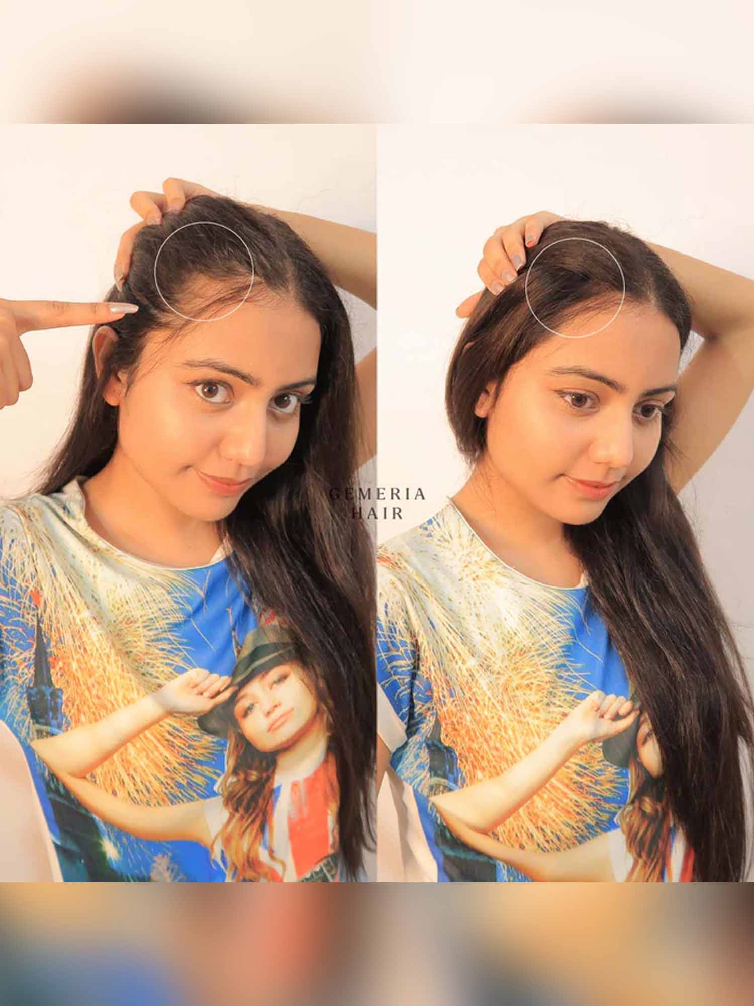 Invisible Spot Cover-Up | 1" Hair Patch