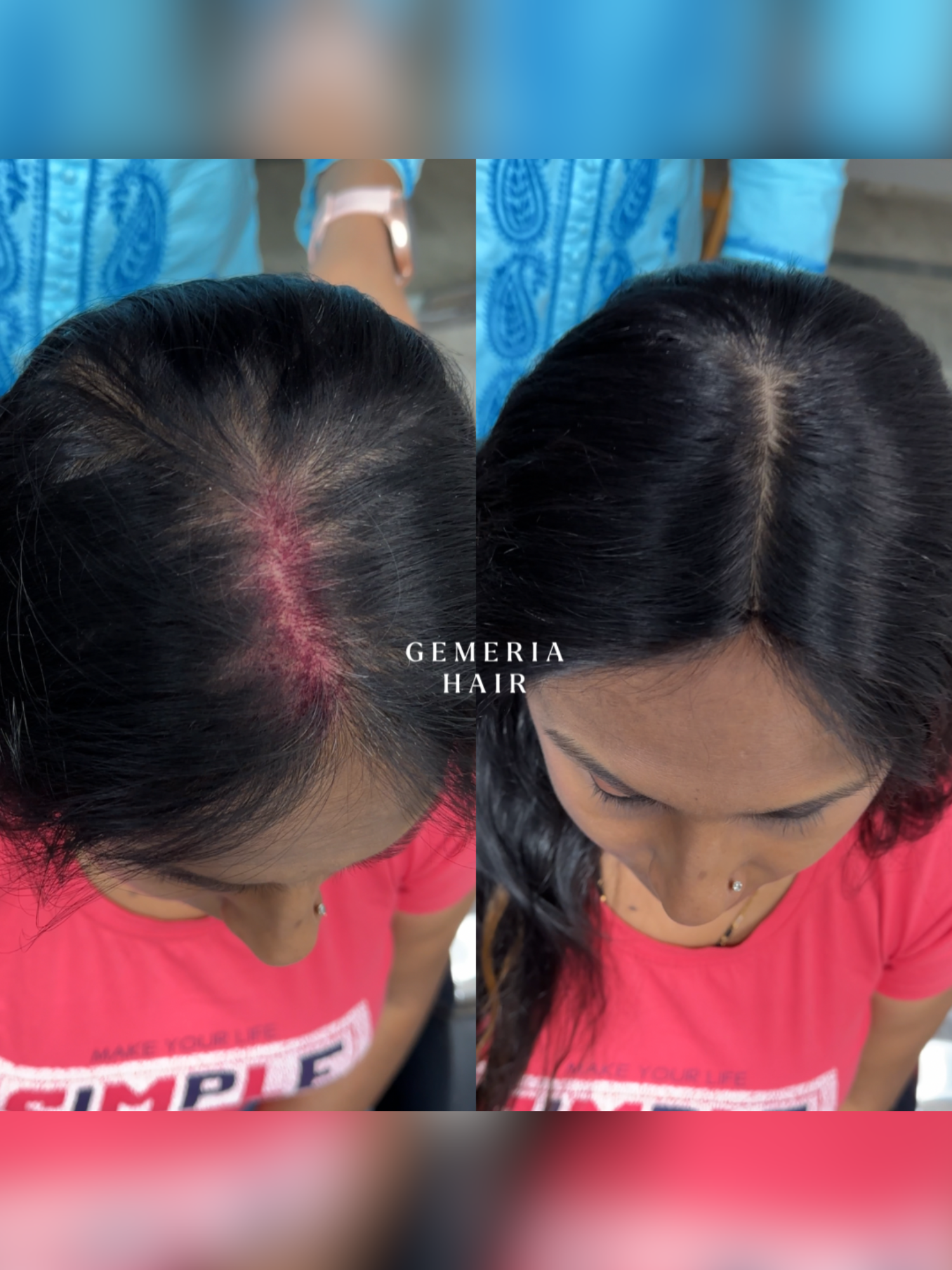 2x4 | Full Silk Hair Topper