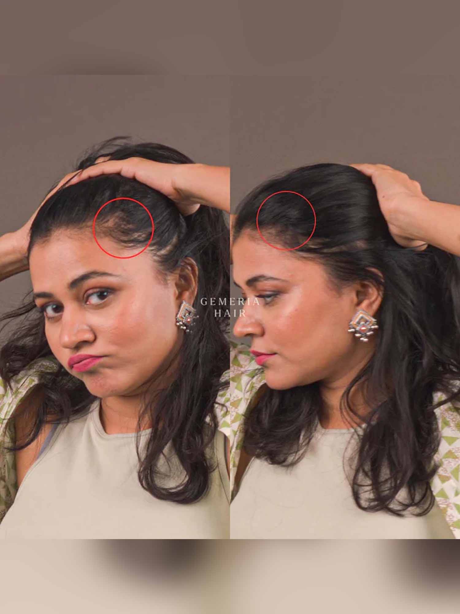 Invisible Spot Cover-Up | 1" Hair Patch