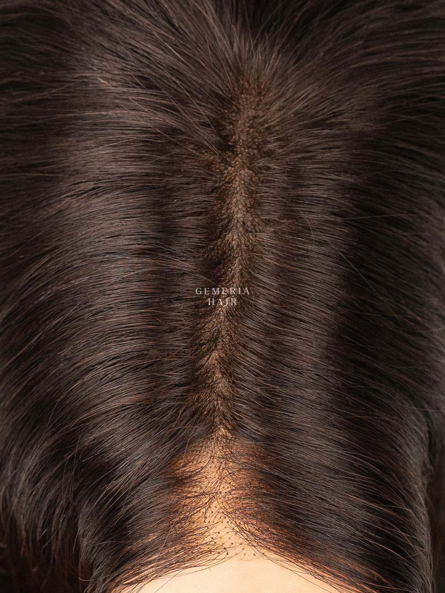 Front Lace 5"x8" Volume Hair Topper | Bio-Base