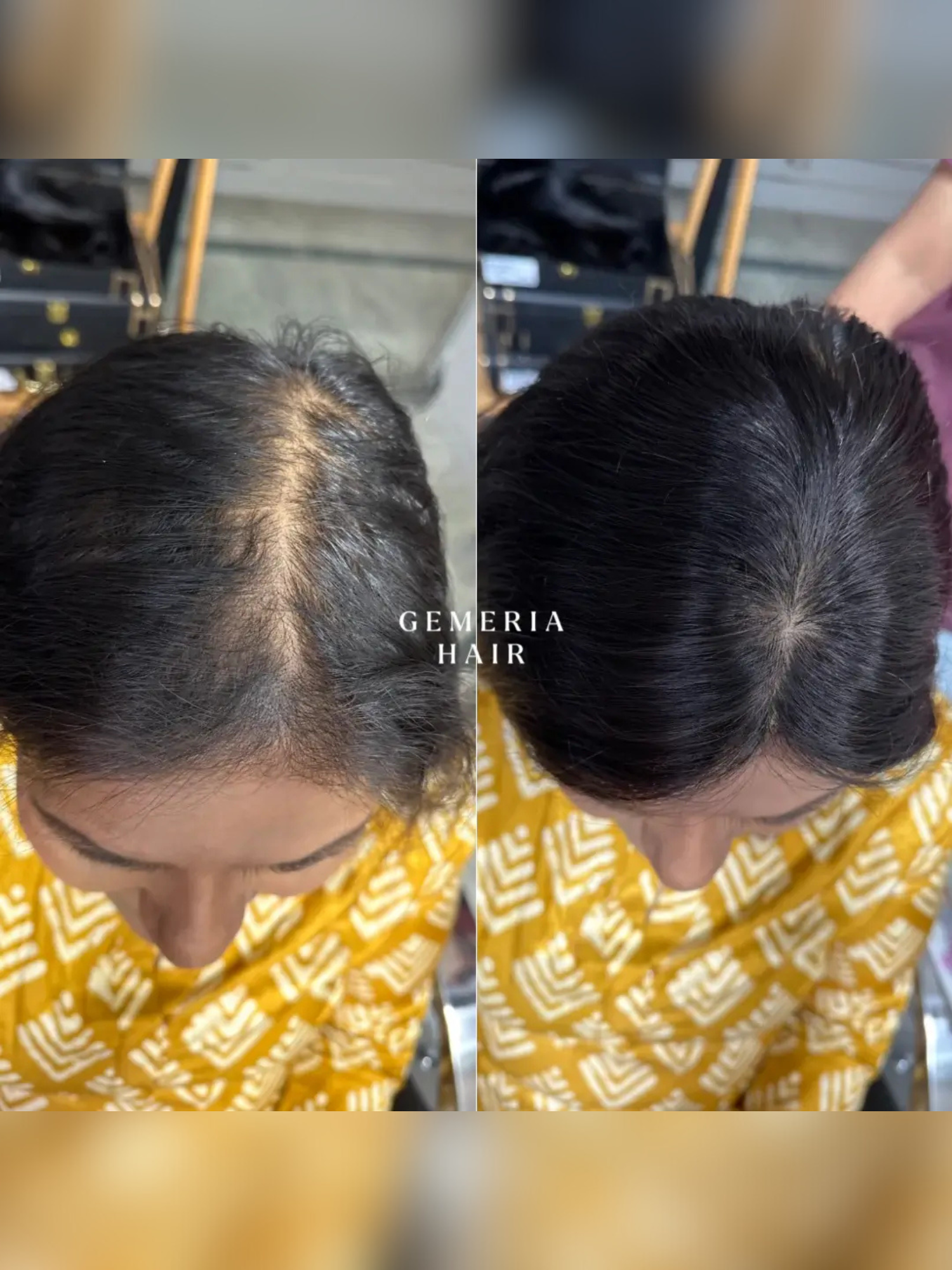 2x4 | Full Silk Hair Topper