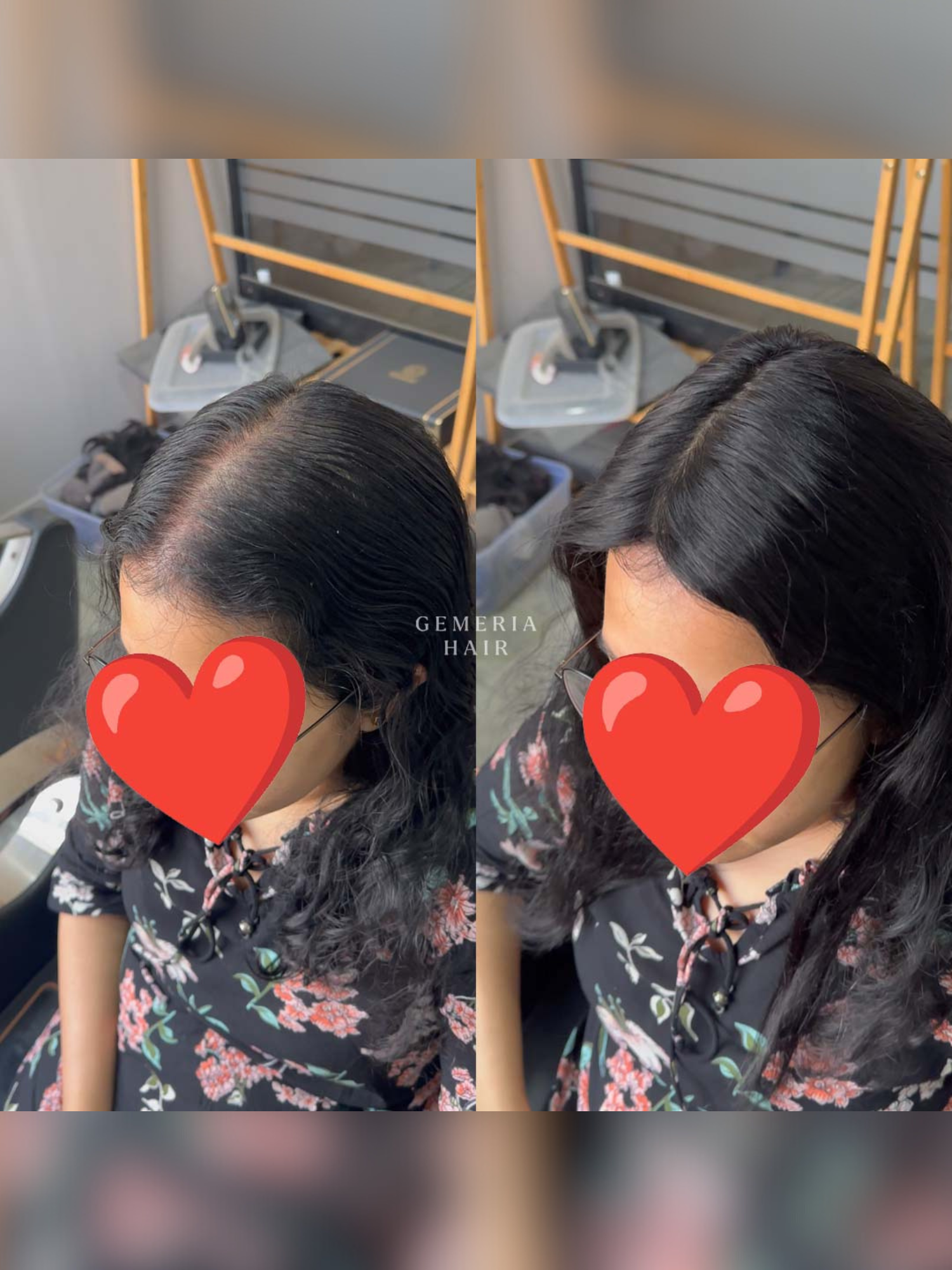 2x6 | Full Silk Hair Topper