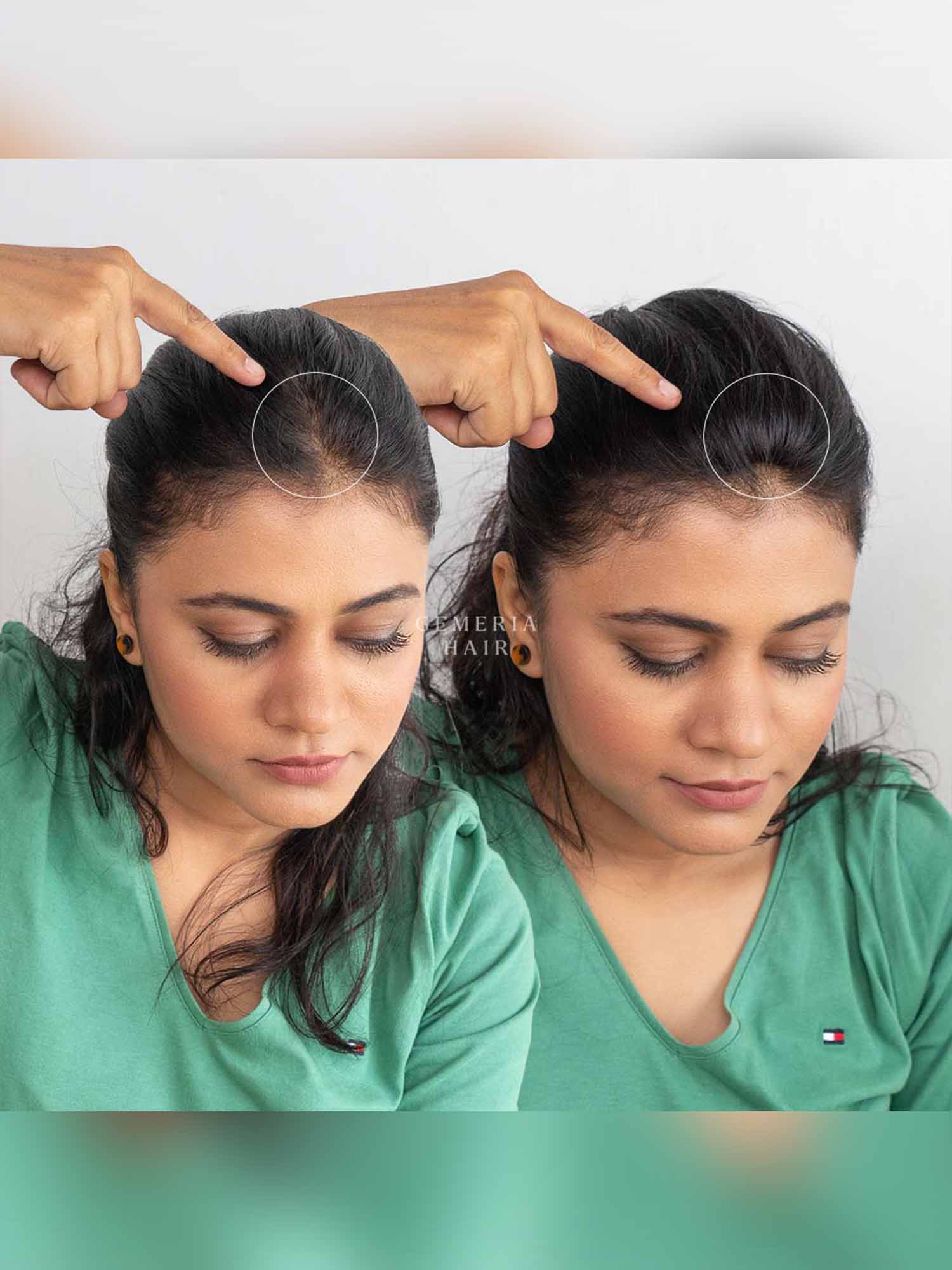 Invisible Spot Cover-Up | 1" Hair Patch