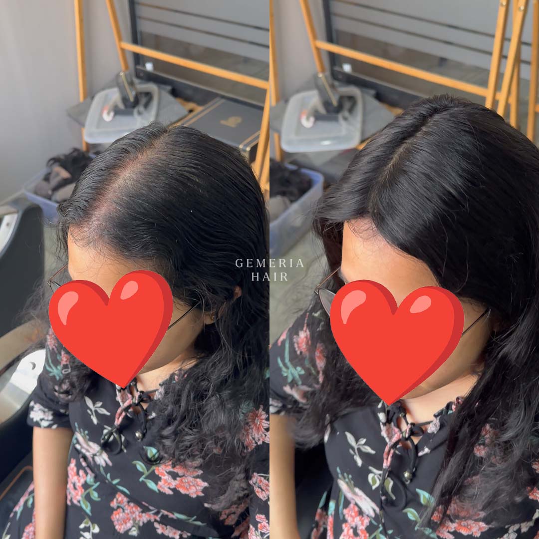 before after applying hair topper