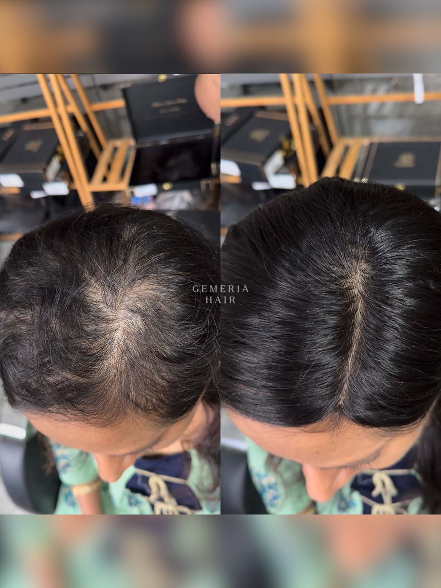 3x5 | Full Silk Hair Topper